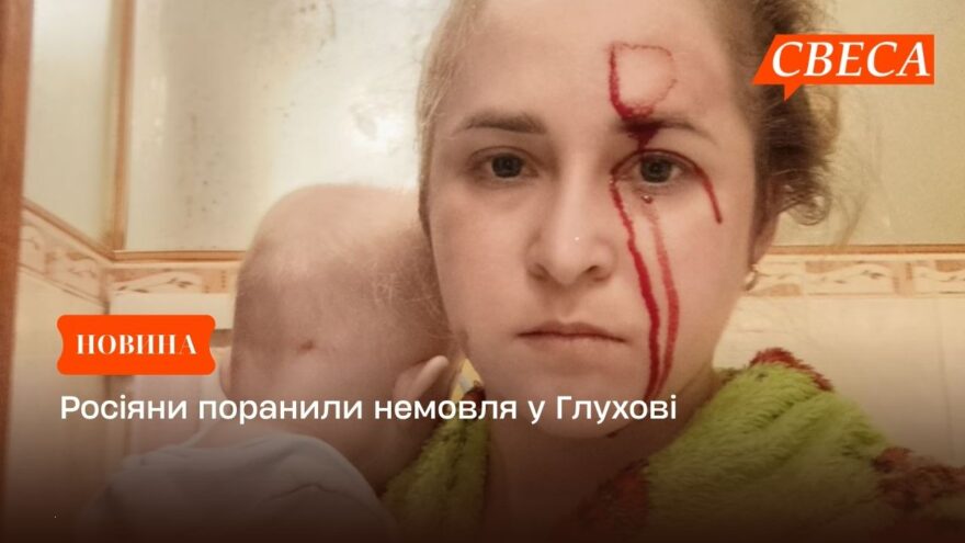 Росіяни поранили немовля у Глухові